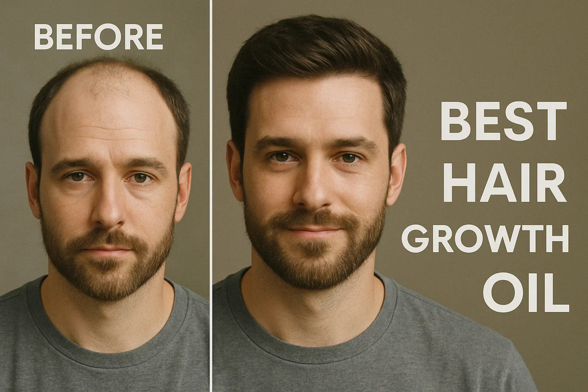 Hair Growth Oil for Men Find the Best Formula for Hair Gain