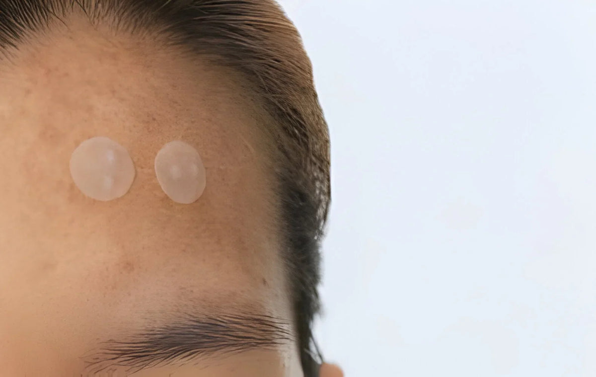 How Long to Leave a Pimple Patches On Get Clear Skin Fast